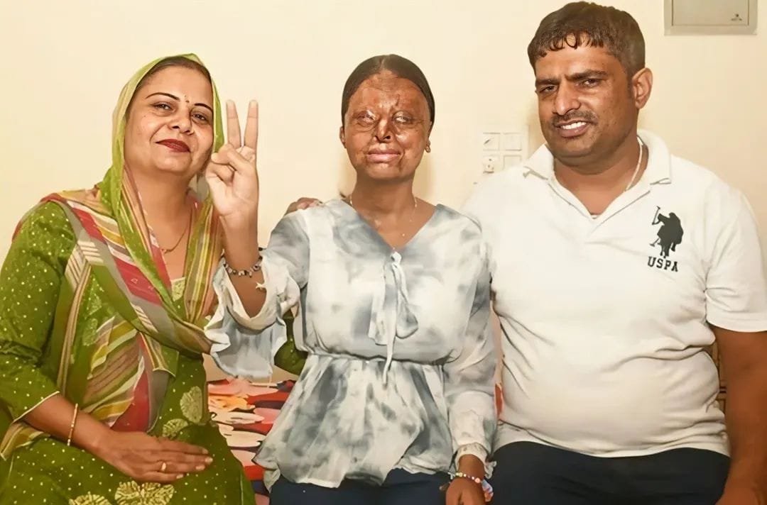 Acid Attack Survivor Kafi Scores 95.6% in CBSE Class 12, Aspires to Become IAS Officer